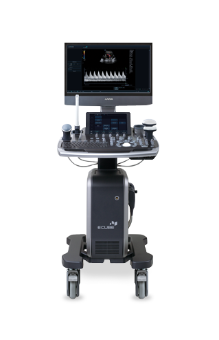 Alpinion E-CUBE 8 Ultrasound